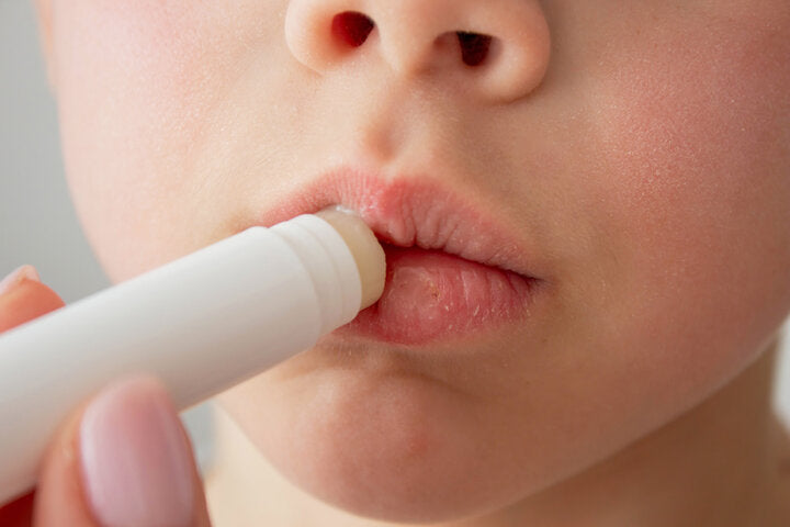 唇部乾燥怎麼辦?從根本改善乾燥困擾