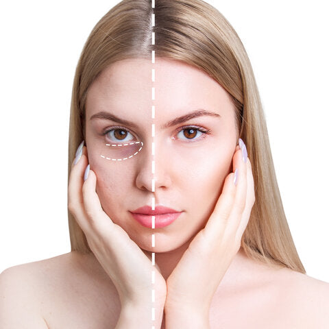 擺脫疲憊眼神,眼周暗沉拯救大作戰!