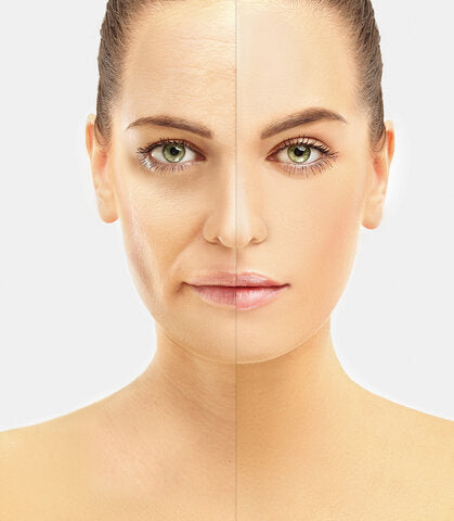 法令紋大作戰!如何有效抗老化?